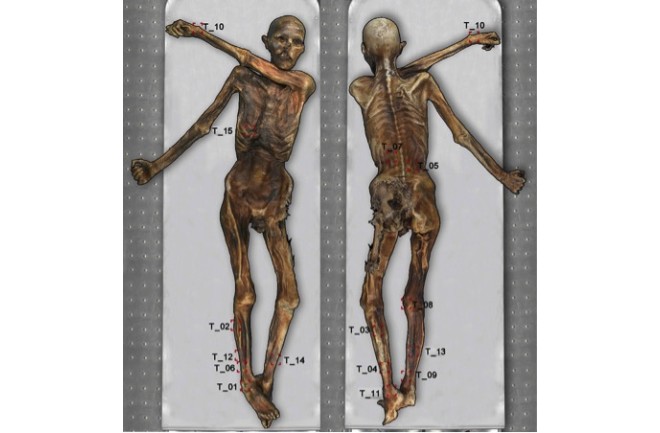 Otzi the Iceman tattoos