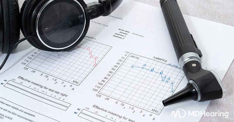 What Is an Audiogram? And How Do You Read It?