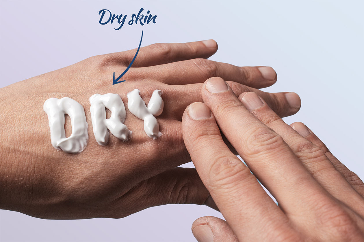 dry-skin-causes-and-treatment