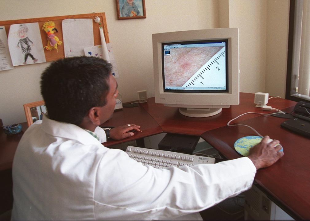 Dermatologist examining skin on screen